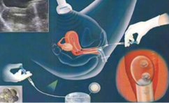 代怀多久开始显肚子？揭秘孕期肚子变化